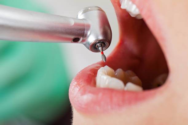 Best 24-Hour Emergency Dental Care in Mpo, CA